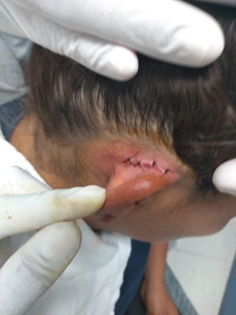 desprenden oreja