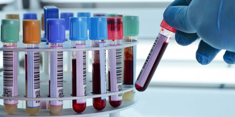 terapia_plasma_nl
